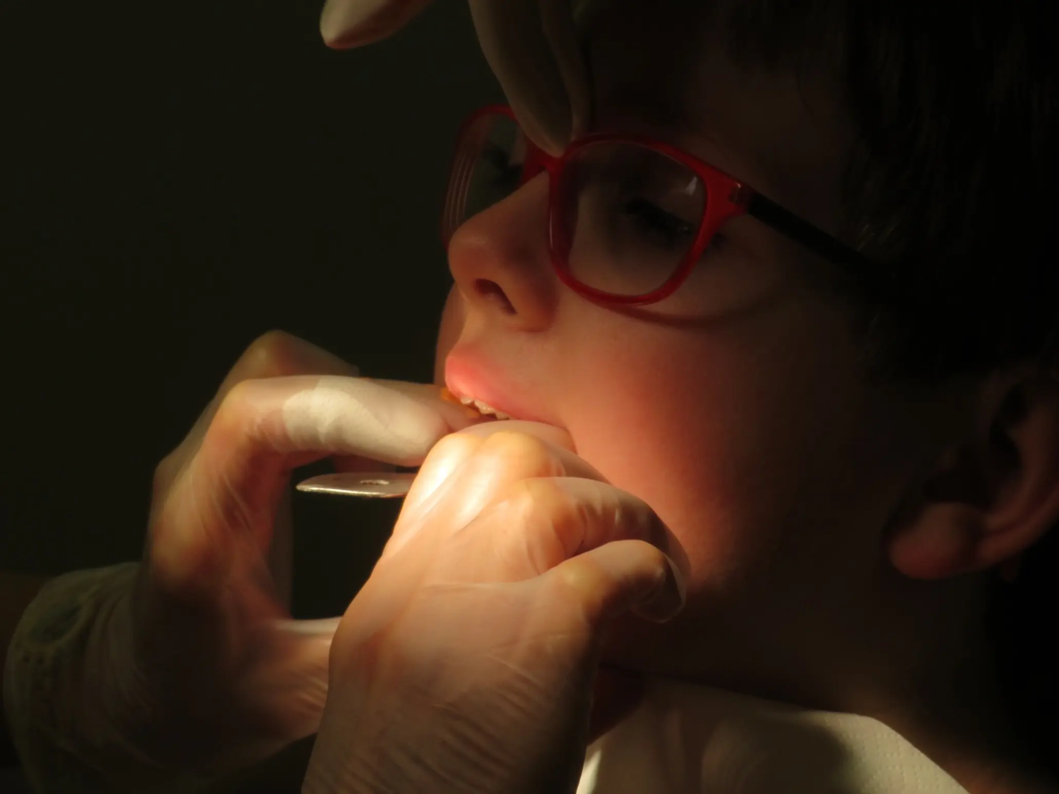 Leczenie kanałowe zębów u dzieci - co musisz o nim wiedzieć